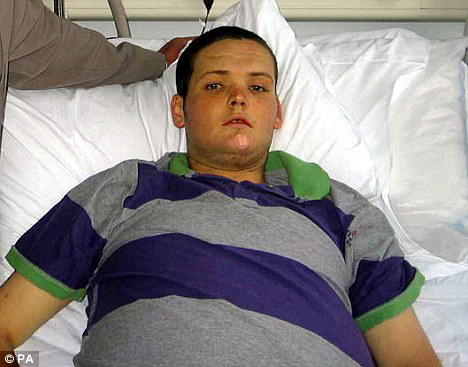 19 Year Old Briton with Alcohol Destroyed Liver Doesn’t Meet Transplant Guidelines