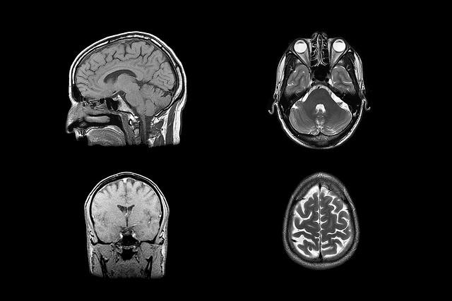 The Behavioral and Neurological Evidence for Food Addiction