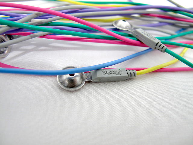 Harvard Researchers Say Electrical Acupuncture Works Well as a Treatment for Opiate Addiction
