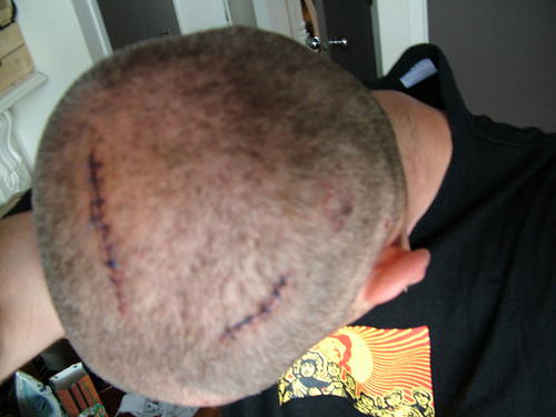 Police Hold Disabled Man on Suspicion of DUI. Suspicious Behaviors Actually a Result of Brain Injury, Not Intoxication
