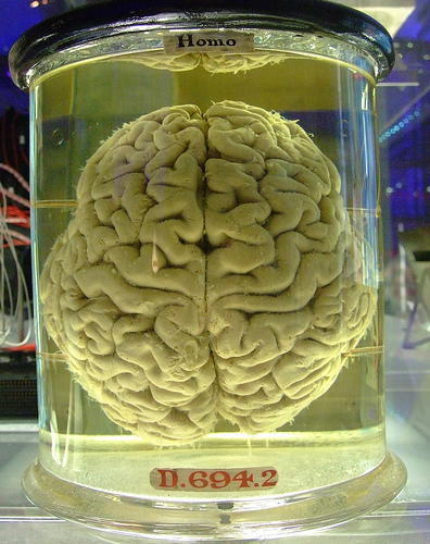 Heavy and Long-Term Marijuana Use Causes Brain Shrinkage