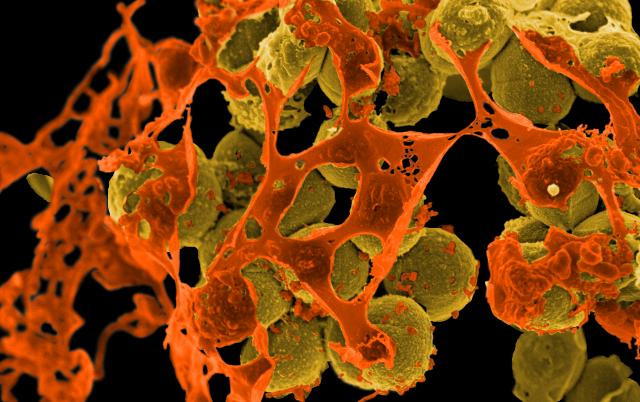 Gut Bacteria Protect Your Mental Health. Learn How to Protect Your Microbiome