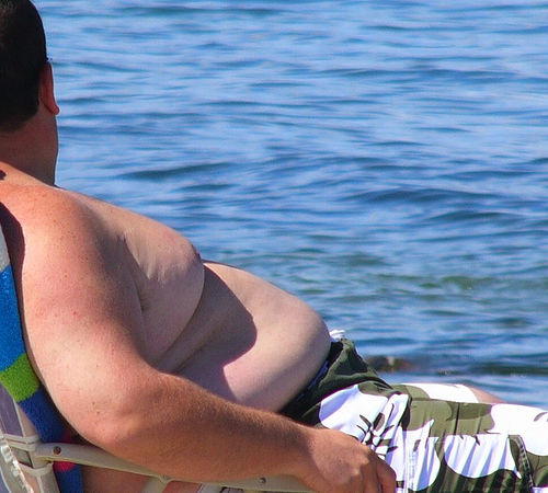 In UK, Obesity to Become Leading Cause of Cirrhosis within 20 Years