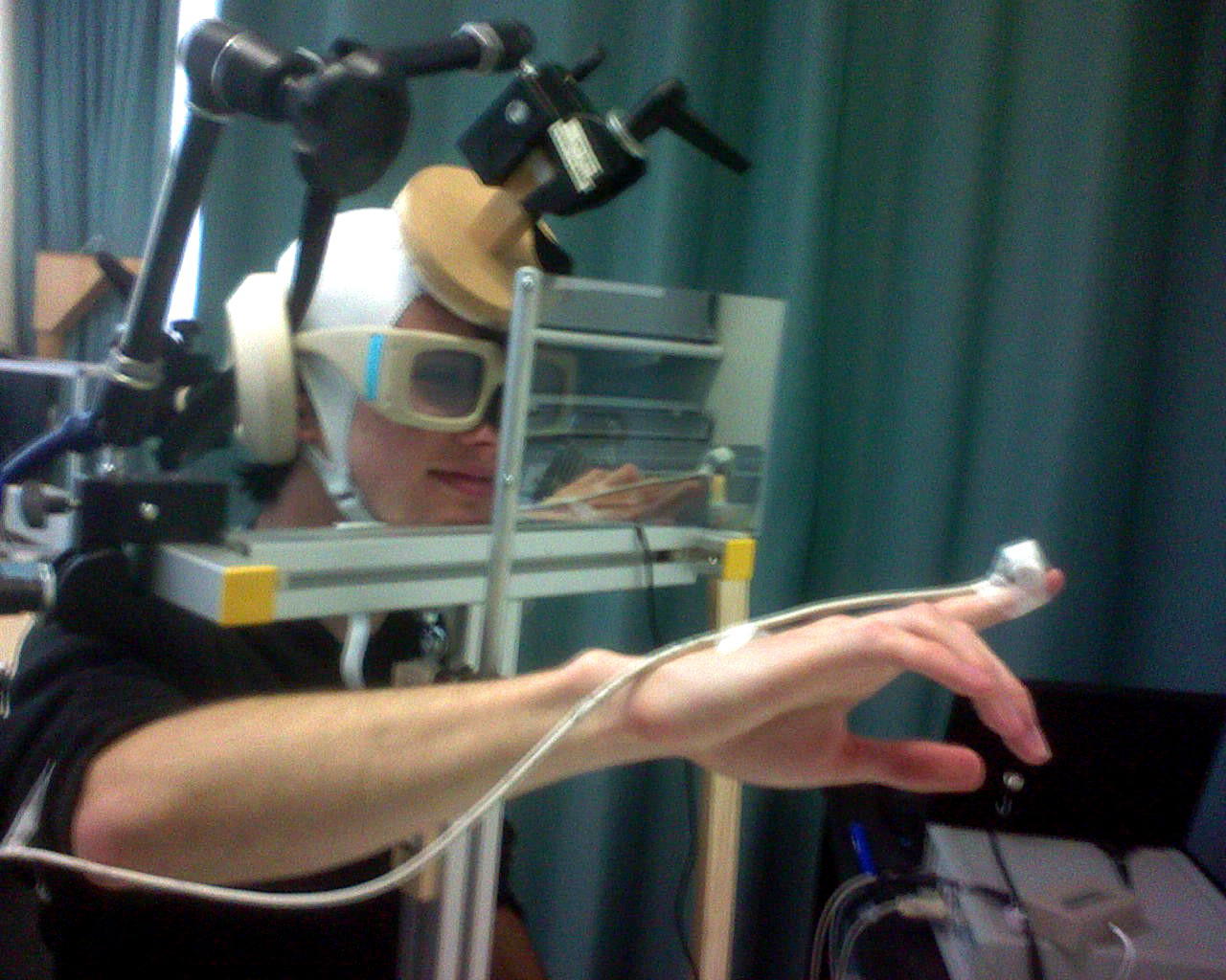 Magnetic Brain Stimulation Is Proven an Effective Therapy for Severe Depression