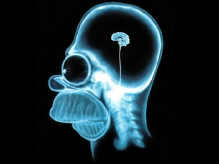 Chinese Researchers Say Internet Addiction Causes Grey Matter Atrophy in Cerebral Cortex
